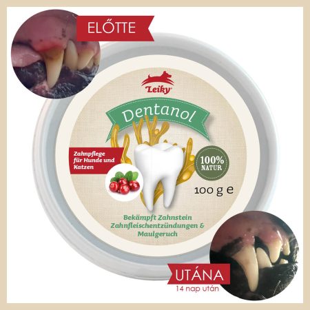 Leiky Dentanol 100% természetes fogkő